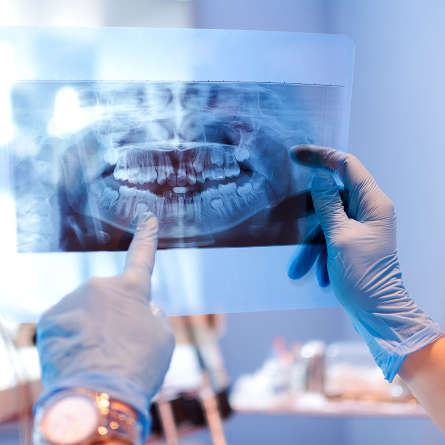 Photo of a dental x-ray